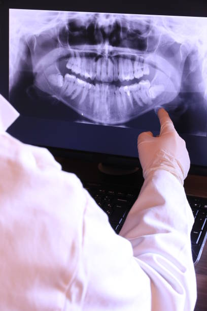 Best Emergency Dental Care for Broken or Chipped Teeth in Drew, MS