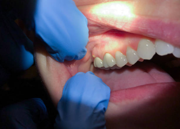 Best Emergency TMJ Treatment in Drew, MS
